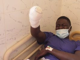 Mbacké: la main d’un « jakartaman » amputée suite à une agression