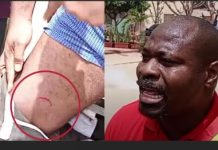 Jets de grenades lacrymogènes à la Cité Keur Gorgui: Guy Marius Sagna touché à la cuisse