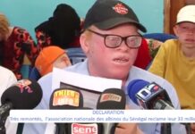 Association nationale des albinos du Sénégal: Le président Bamba Diop accusé de détournement de 33 millions F CFA